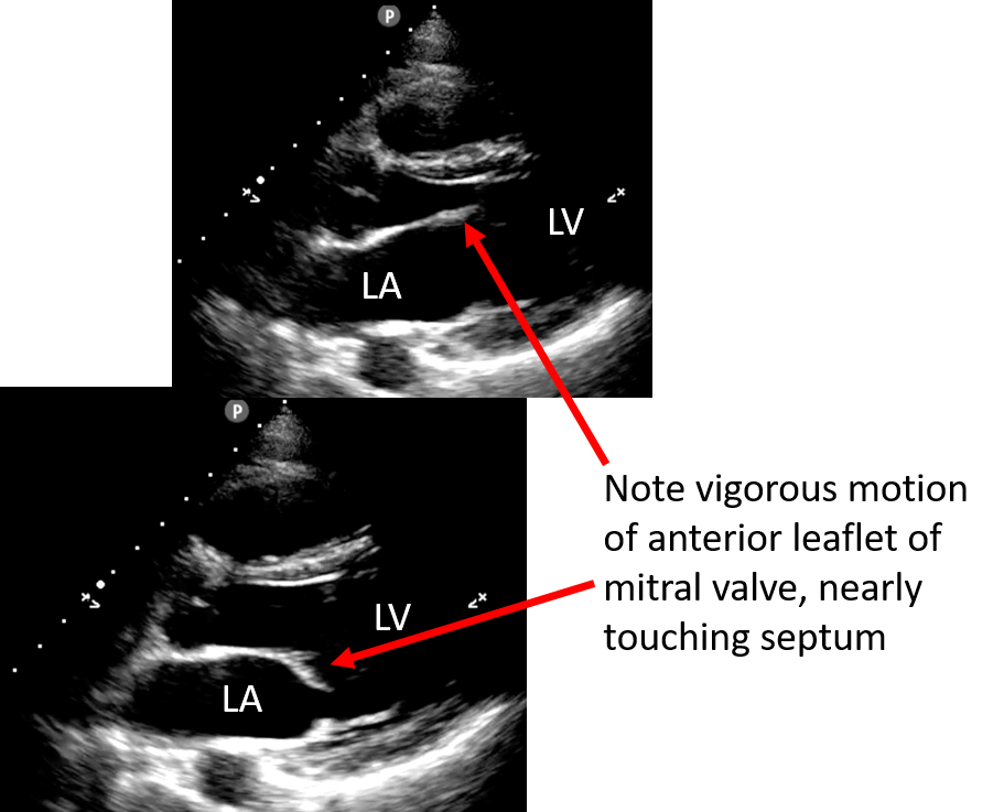 annotated ultrasound image