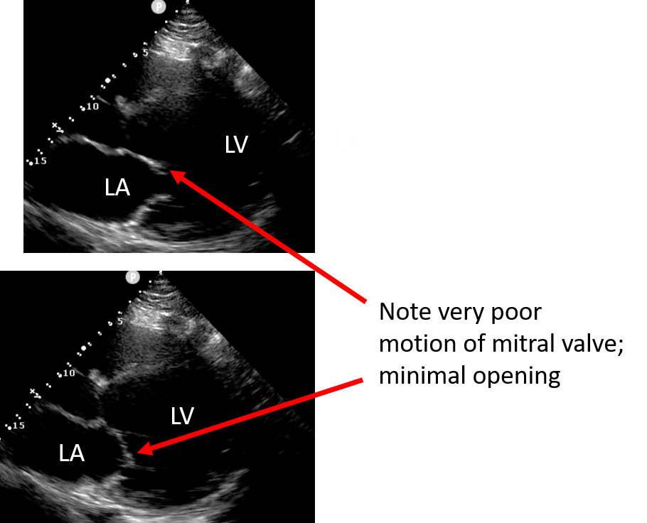 annotated ultrasound image