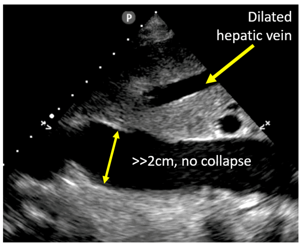 ultrasound media image 176-2a