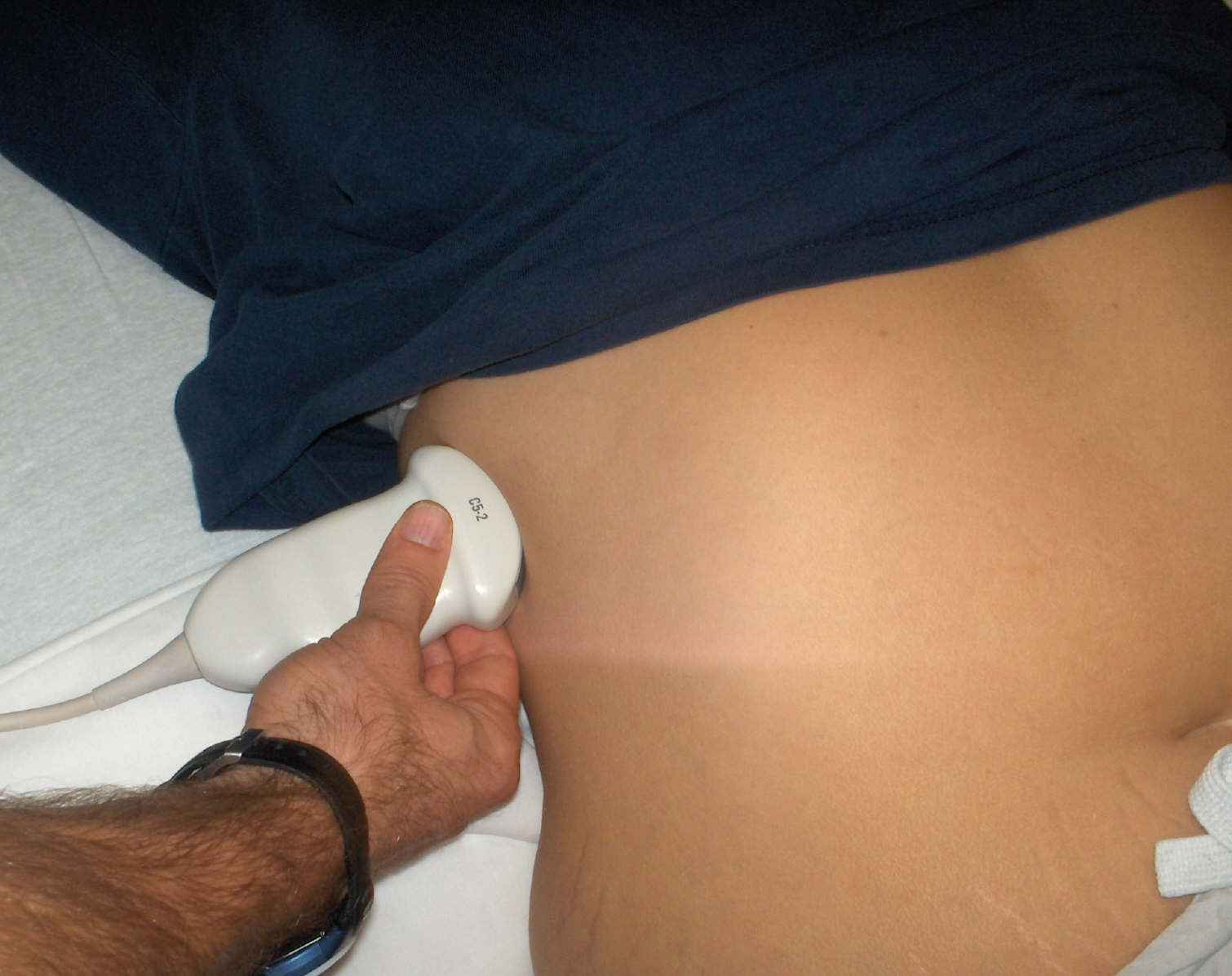 renal ultrasound sensor position