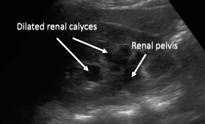 anotated ultrasound image