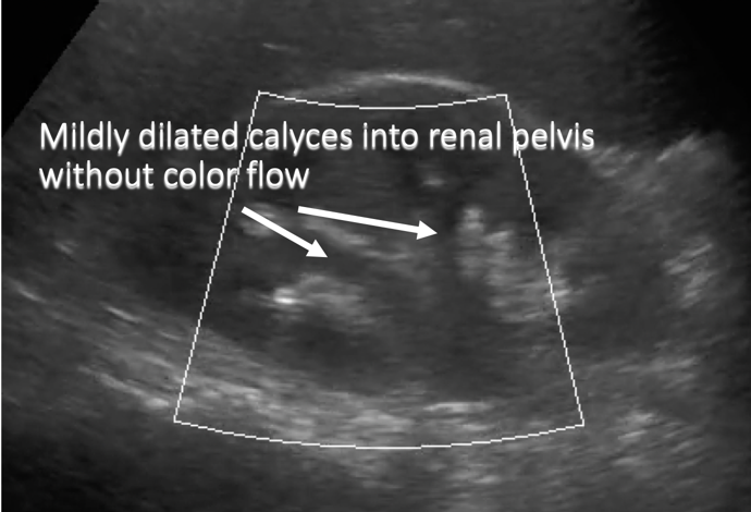 anotated ultrasound image