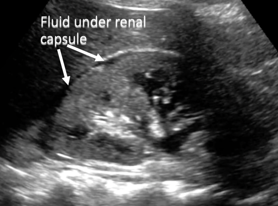 annotated point of care ultrasound image