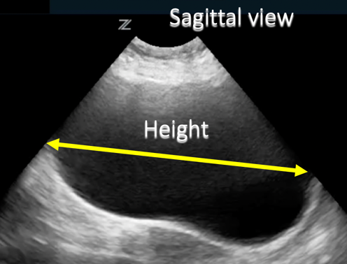 annotated point of care ultrasound image 1