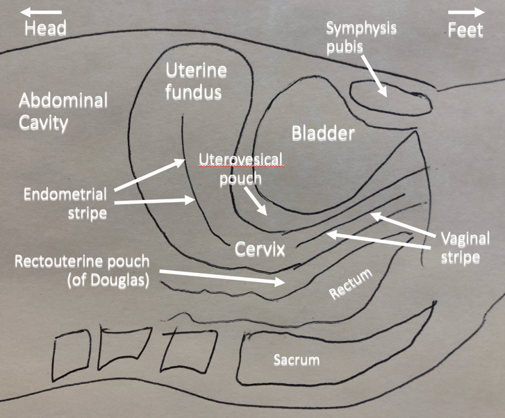 sagittal anatomy for ultrasound