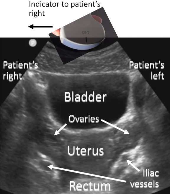 annotated ultrasound sagittal anatomy