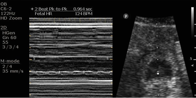 ultrasound display