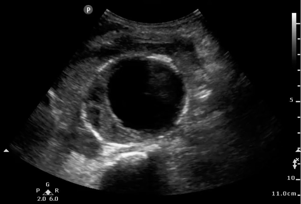 sonography image for q&a 1