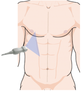 ultrasound sensor position for pleural effusion