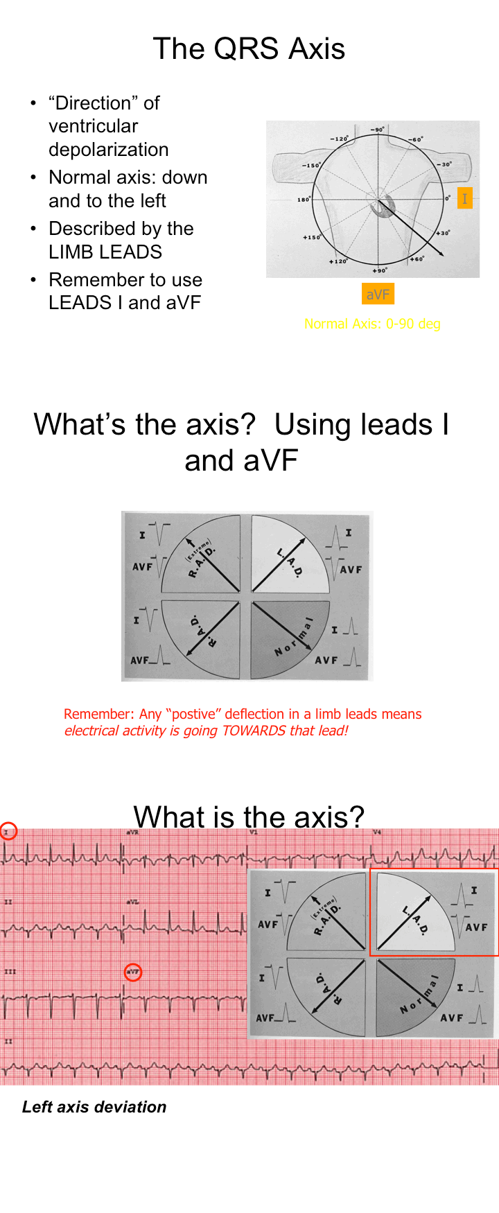 qrs axis