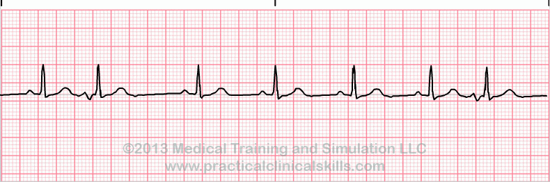 ECG Practice Drill