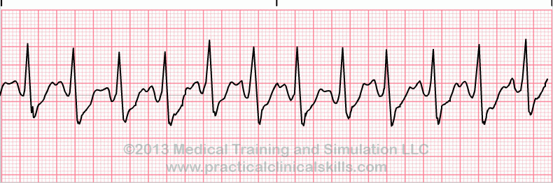 ECG Practice Drill