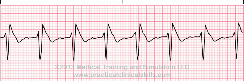 Comprehensive ECG Quiz | Multiple Choice Graded Quiz