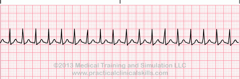 EKG Practice Drill