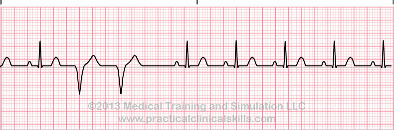 ECG Practice Drill