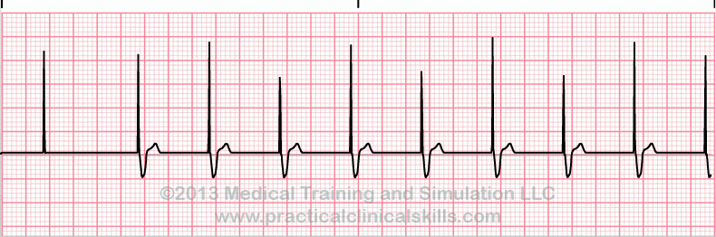 EKG Practice Drill