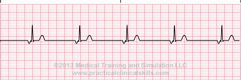 EKG Practice Drill