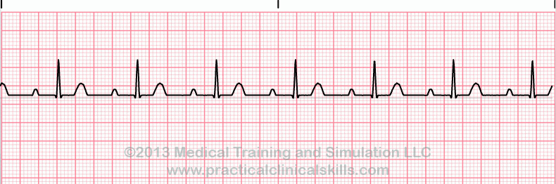 ECG Practice Drill