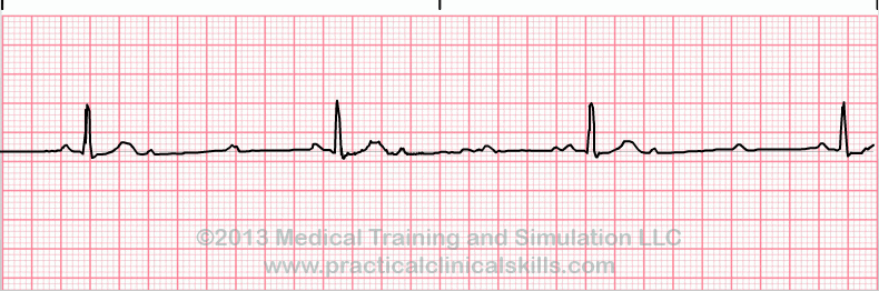 EKG Interpretation Coaching