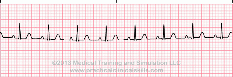 EKG - Estos ejercicios prácticos 