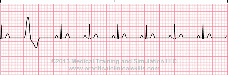 ECG Practice Drill