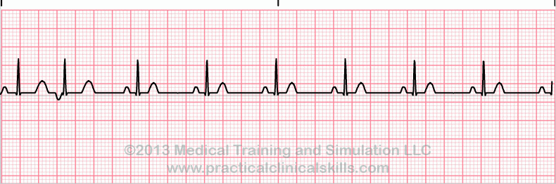 ECG Practice