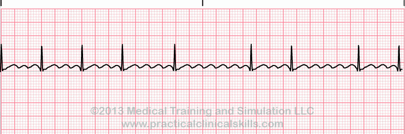 ECG Practice Drill