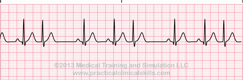 ECG Practice Drill