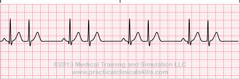 EKG Practice Drill