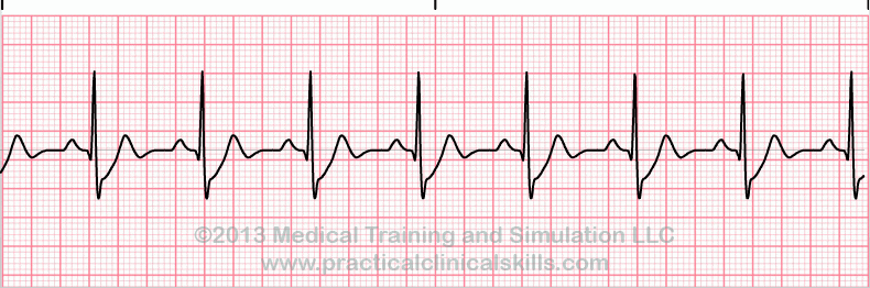 EKG Practice Drill