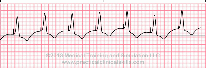 ECG Practice Drill