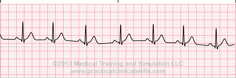 Essential EKGs for Nurses | Multiple Choice Graded Quiz