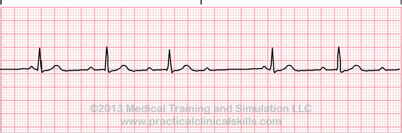EKG - Estos ejercicios prácticos 