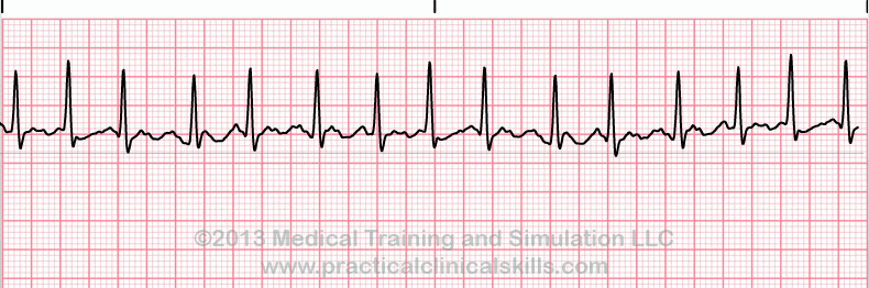 EKG Practice Drill