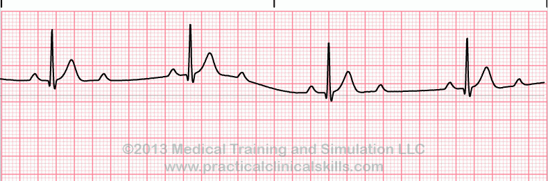 Essential EKGs for Nurses | Multiple Choice Graded Quiz