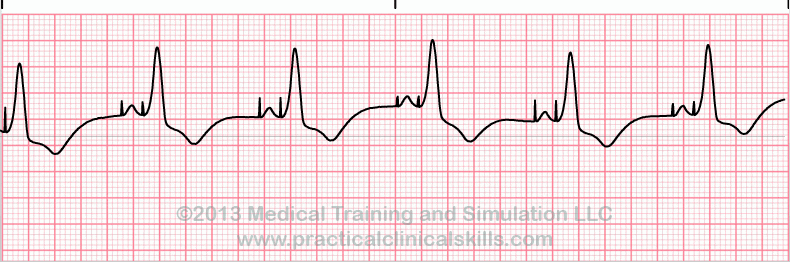 ecg-practice-drill