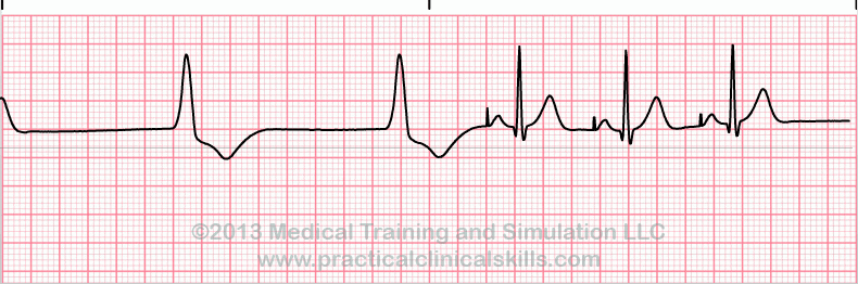 ecg rhythm strip for quiz