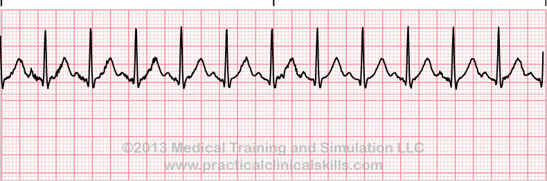 ecg-practice-drill