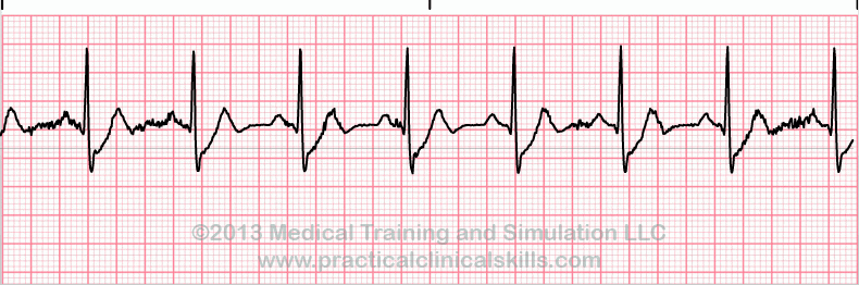 EKG Practice Drill