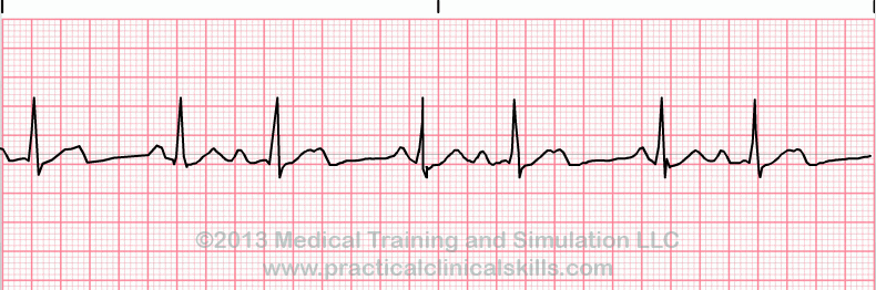 ecg-practice-drill