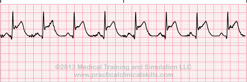 ECG Practice Drill