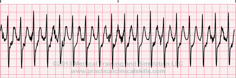 Ekg Practice Drill