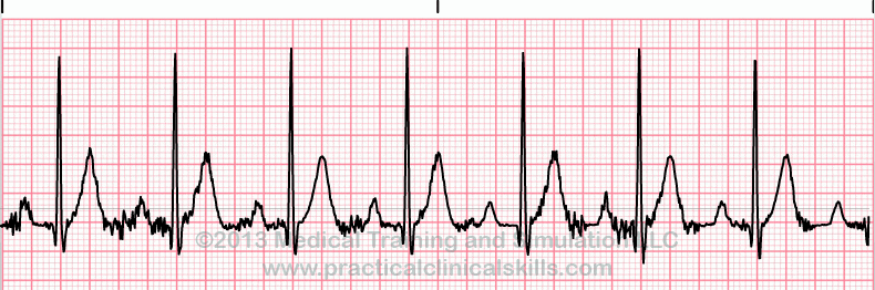 Comprehensive Ecg Quiz 