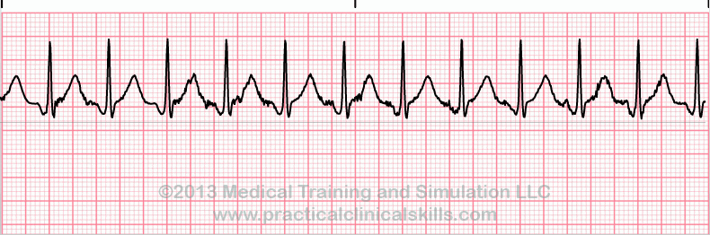 ECG Practice Drill