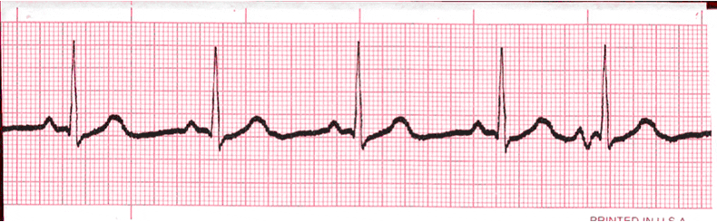 ECG Practice Drill