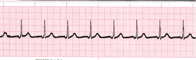 Ekg Practice Drill