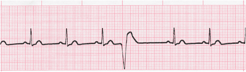 EKG Interpretation Coaching