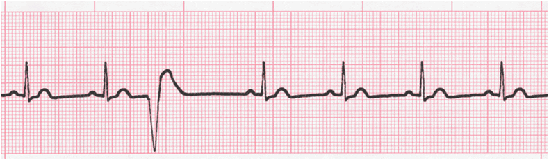 EKG Interpretation Coaching