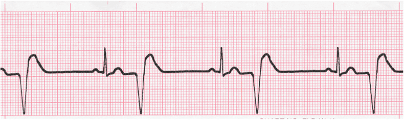 EKG Interpretation Coaching