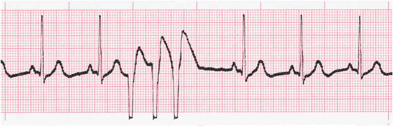 EKG - Estos ejercicios prácticos 